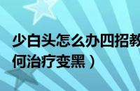 少白头怎么办四招教你治疗少白头（少白头如何治疗变黑）
