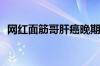 网红面筋哥肝癌晚期进ICU：已下病危通知
