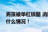 男孩被单杠锁腿 消防到场1分钟救出 具体是什么情况！