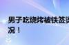 男子吃烧烤被铁签烫成微笑唇 具体是什么情况！